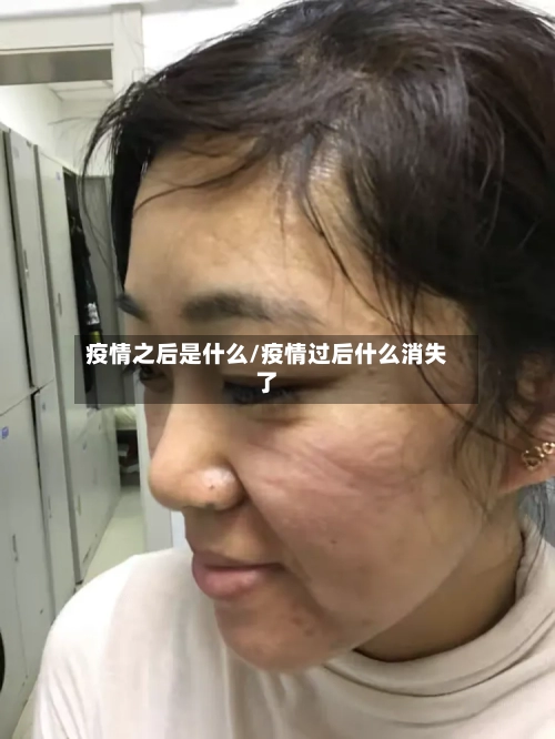 疫情之后是什么/疫情过后什么消失了